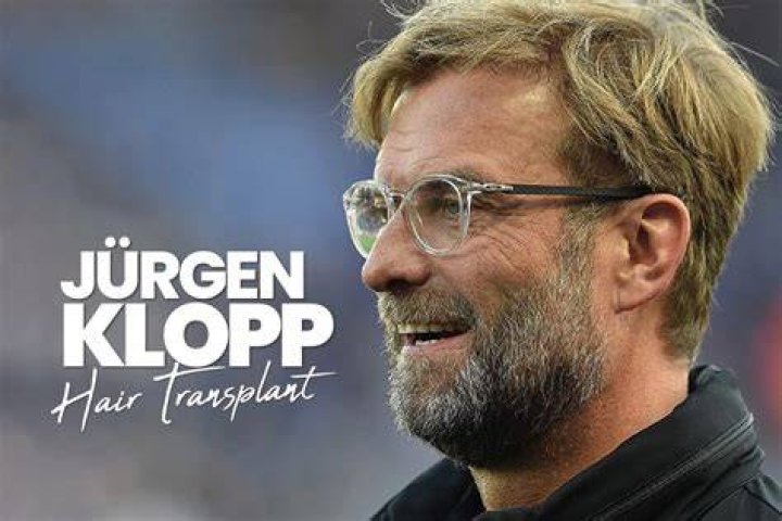 J&uuml;rgen Klopp