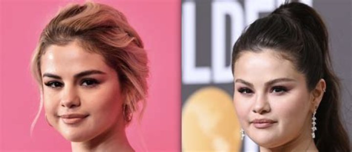 Selena Gomez Breast Implants Plastic Surgery Before and After