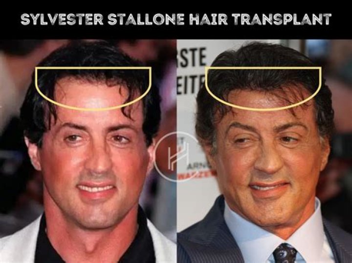 Why does Sylvester have a lisp?